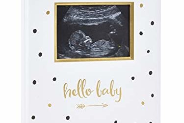 Pearhead First 5 Years Baby Memory Book with Sonogram Photo Insert, Black and Gold Polka Dot