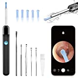 Ear Wax Removal, 1296P HD Earwax Removal Tool with Camera, Wireless Ear Cleaner with 6 LED Lights Built-in WiFi IP67 Waterproof for iOS & Android