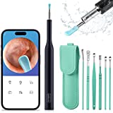 Ear Wax Removal,Earwax Removal Tools,lookcctv Ear Cleaner with Camera HD 1080P Ear Cleaning Kit with 6 Ear Spoon,Ear Remover Tools with Light Compatible iOS & Android Devices for Kids Adults(Blue)